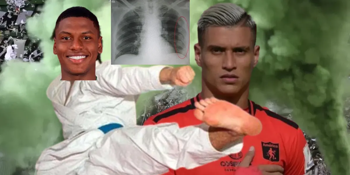 El jugador del América no pudo seguir en el partido como producto del golpe.